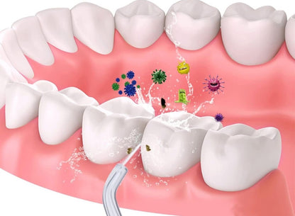 Irrigador Bucal Portátil Recargable | Limpieza Dental Profesional en Casa | 4 puntas + Envio Gratis