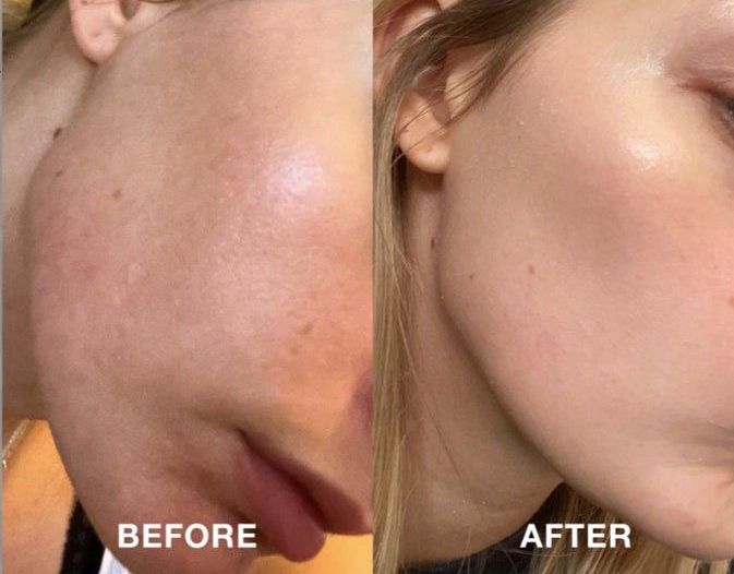 Kit 4 Serums The Ordinary + Envio Gratis