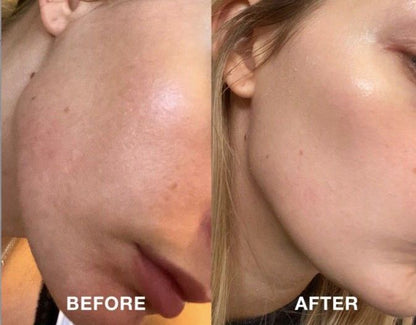 Kit 4 Serums The Ordinary + Envio Gratis