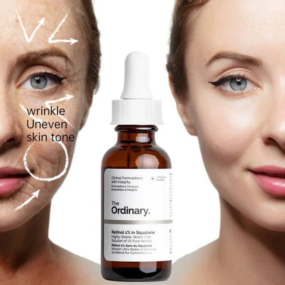 Kit 4 Serums The Ordinary + Envio Gratis