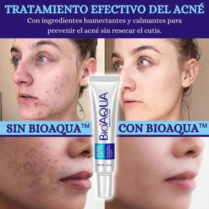 Jabón -  Limpiador Facial BioAQUA Anti Acne + Envio Gratis