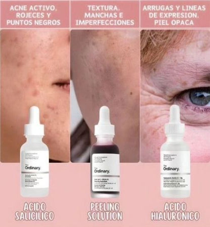 Kit 4 Serums The Ordinary + Envio Gratis